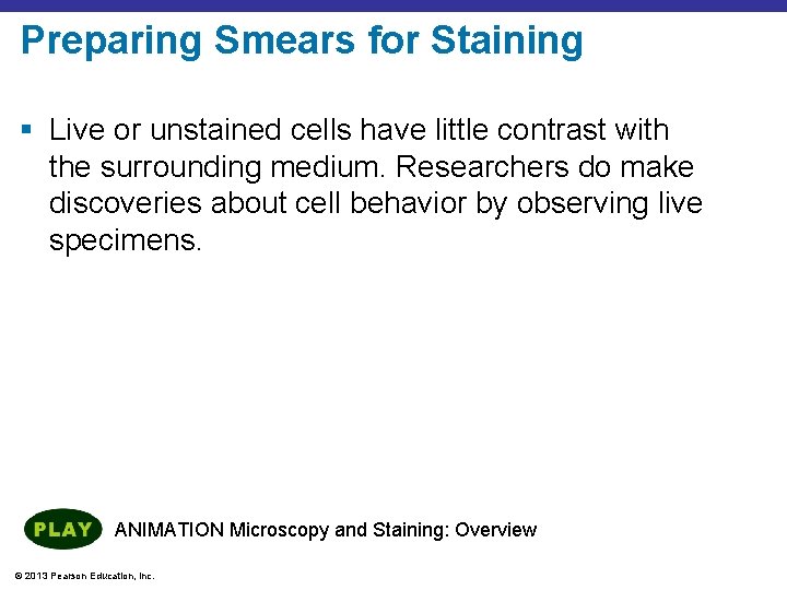 Preparing Smears for Staining § Live or unstained cells have little contrast with the