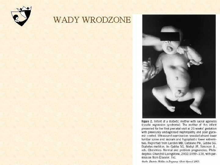 WADY WRODZONE 