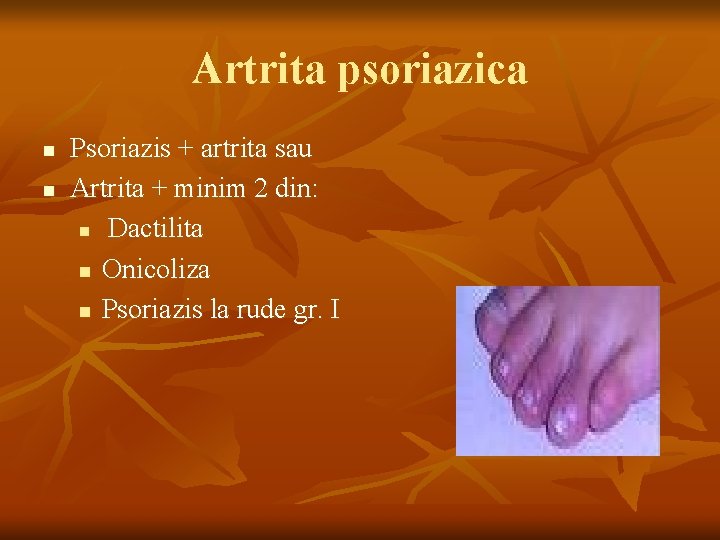 Artrita psoriazica n n Psoriazis + artrita sau Artrita + minim 2 din: n