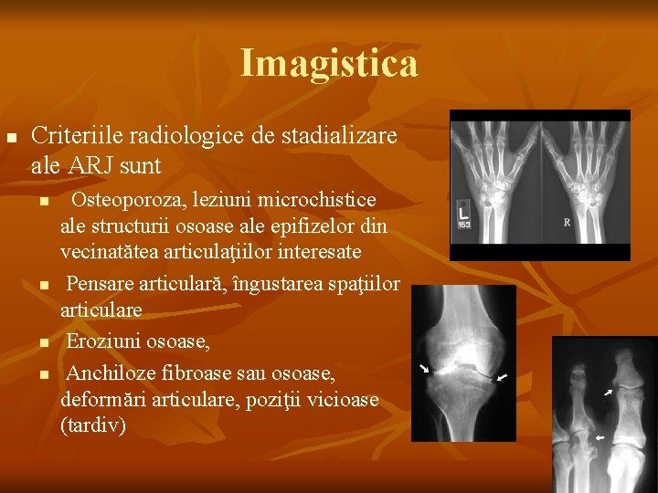 Imagistica n Criteriile radiologice de stadializare ale ARJ sunt n n Osteoporoza, leziuni microchistice