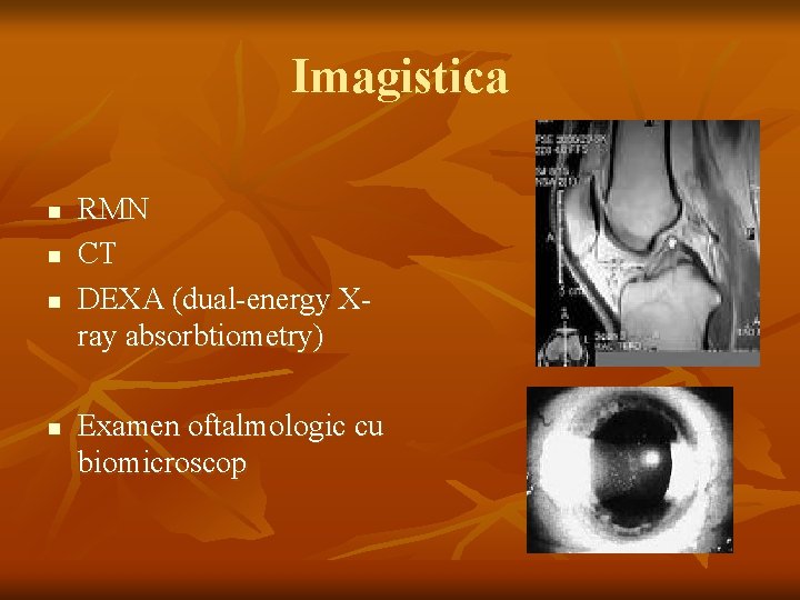 Imagistica n n RMN CT DEXA (dual-energy Xray absorbtiometry) Examen oftalmologic cu biomicroscop 
