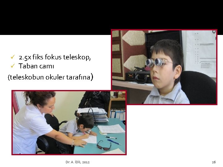 ü ü 2. 5 x fiks fokus teleskop, Taban camı (teleskobun okuler tarafına) Dr.