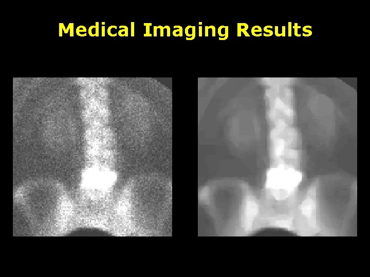 Medical Imaging Results 