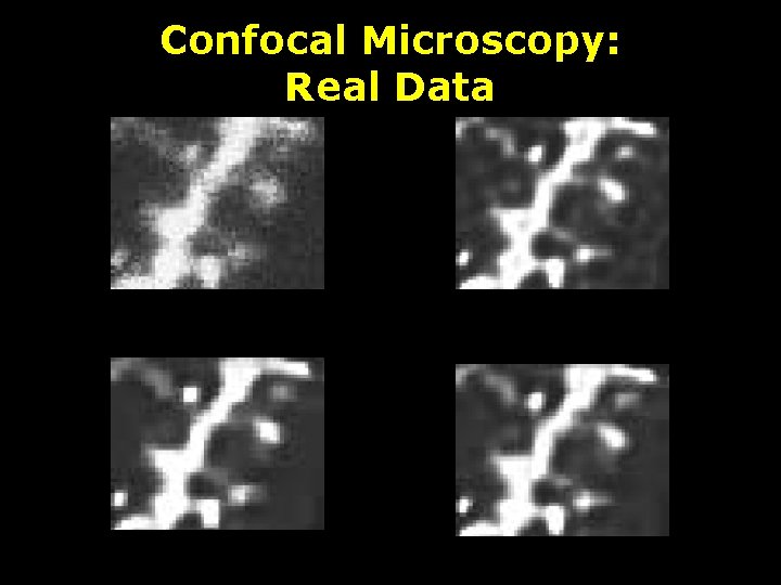 Confocal Microscopy: Real Data 