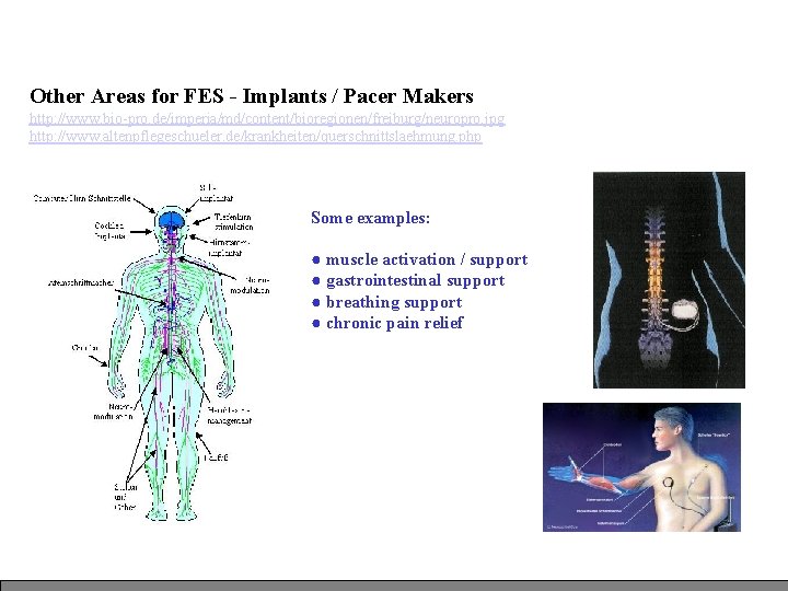 Other Areas for FES - Implants / Pacer Makers http: //www. bio-pro. de/imperia/md/content/bioregionen/freiburg/neuropro. jpg
