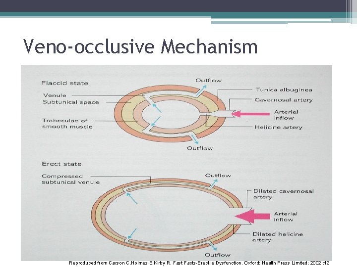 Veno-occlusive Mechanism Reproduced from Carson C, Holmes S, Kirby R. Fast Facts-Erectile Dysfunction. Oxford: