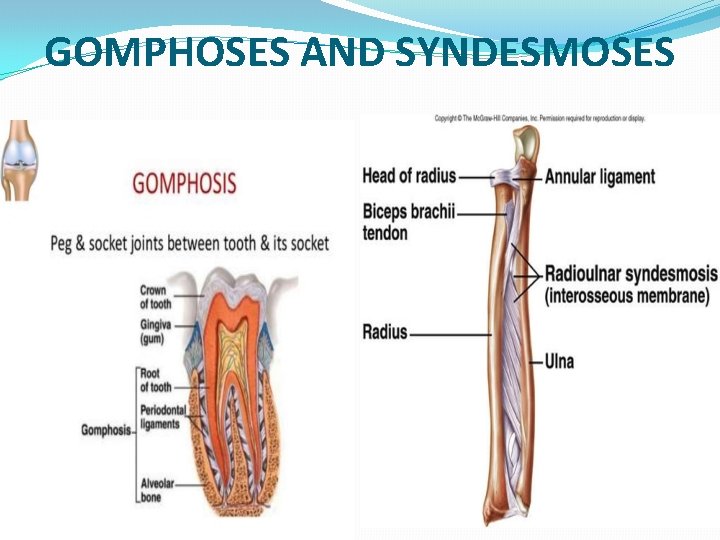 GOMPHOSES AND SYNDESMOSES 
