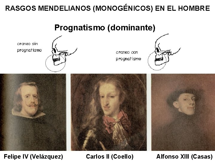 RASGOS MENDELIANOS (MONOGÉNICOS) EN EL HOMBRE Prognatismo (dominante) Felipe IV (Velázquez) Carlos II (Coello)