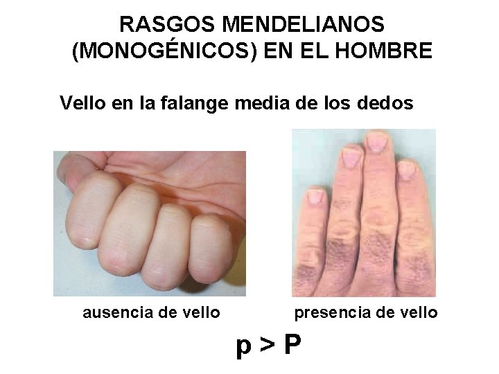 RASGOS MENDELIANOS (MONOGÉNICOS) EN EL HOMBRE Vello en la falange media de los dedos
