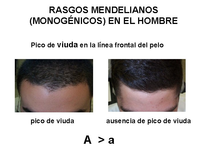 RASGOS MENDELIANOS (MONOGÉNICOS) EN EL HOMBRE Pico de viuda en la línea frontal del