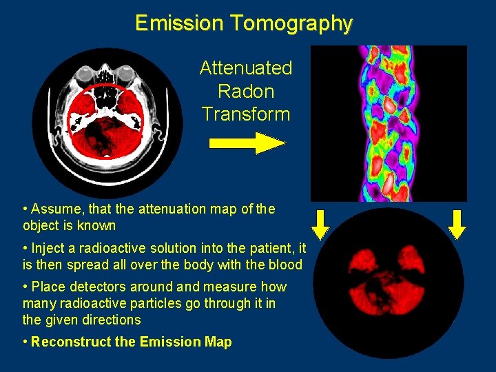 Emission Tomography Attenuated Radon Transform • Assume, that the attenuation map of the object