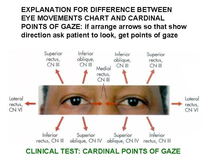 EXPLANATION FOR DIFFERENCE BETWEEN EYE MOVEMENTS CHART AND CARDINAL POINTS OF GAZE: if arrange