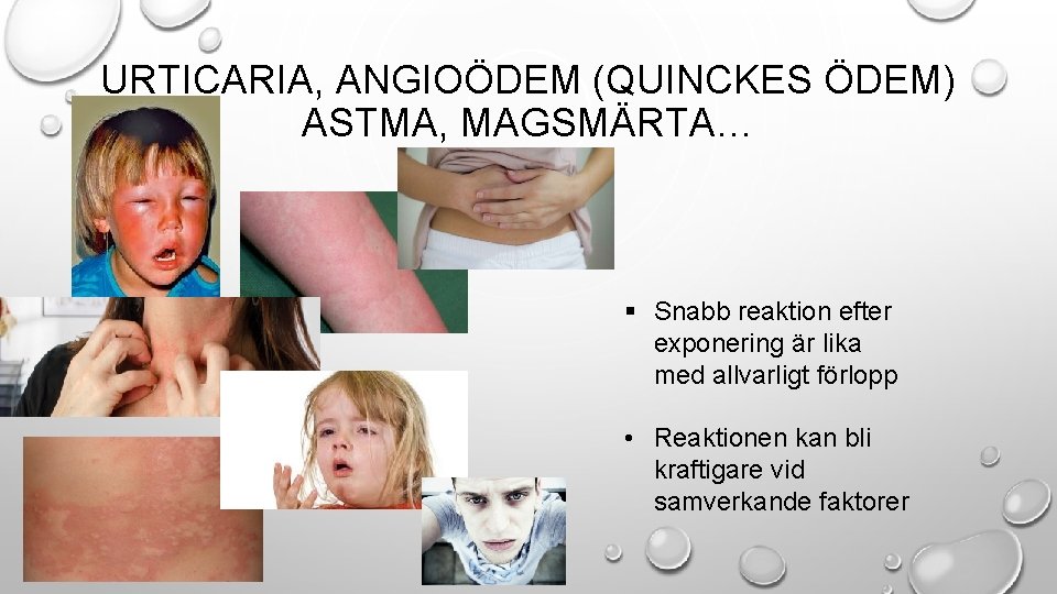 URTICARIA, ANGIOÖDEM (QUINCKES ÖDEM) ASTMA, MAGSMÄRTA… § Snabb reaktion efter exponering är lika med