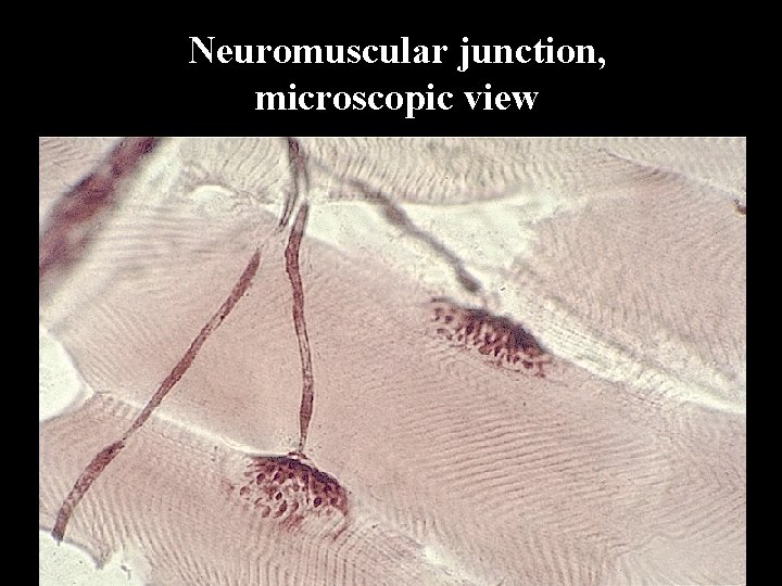 Neuromuscular junction, microscopic view 