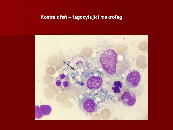 Kostní dřeň – fagocytující makrofág 