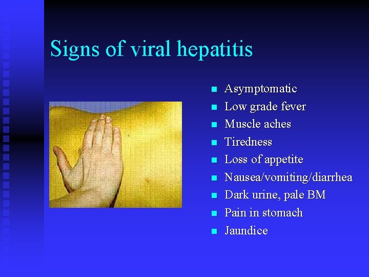 Signs of viral hepatitis n n n n n Asymptomatic Low grade fever Muscle