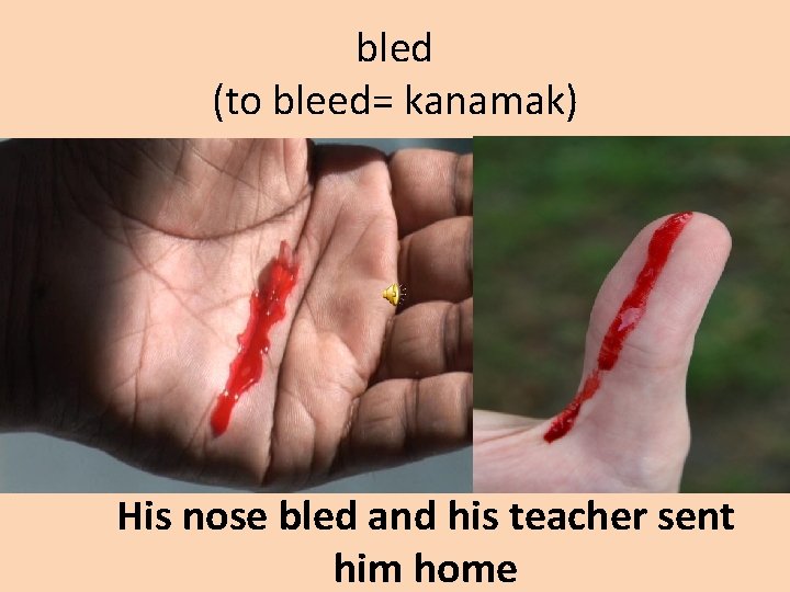 bled (to bleed= kanamak) His nose bled and his teacher sent him home 