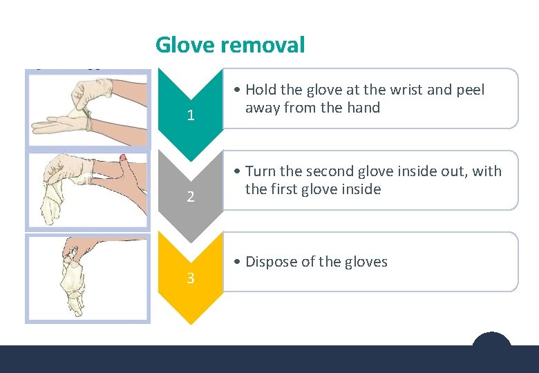 Glove removal 1 • Hold the glove at the wrist and peel away from