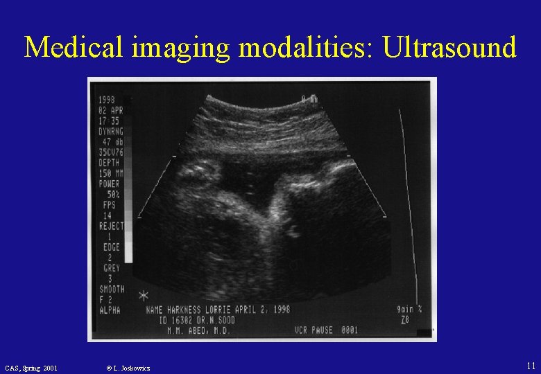 Medical imaging modalities: Ultrasound CAS, Spring 2001 © L. Joskowicz 11 