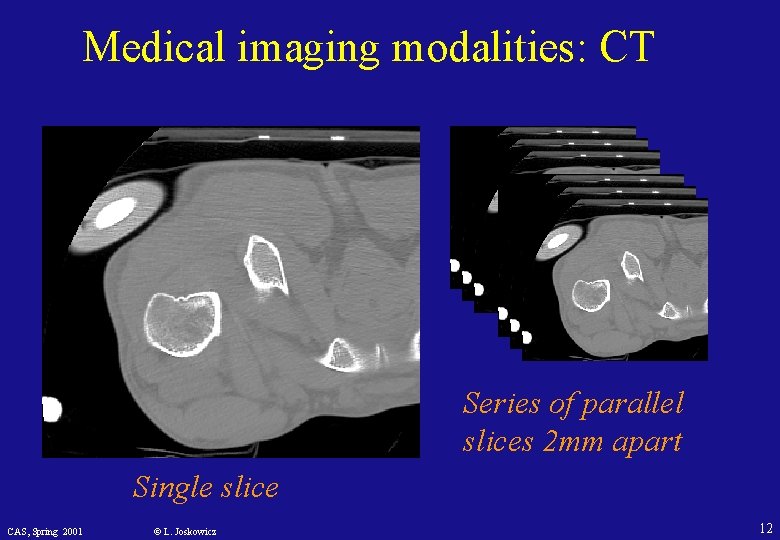 Medical imaging modalities: CT Series of parallel slices 2 mm apart Single slice CAS,