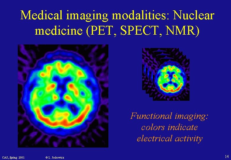 Medical imaging modalities: Nuclear medicine (PET, SPECT, NMR) Functional imaging: colors indicate electrical activity