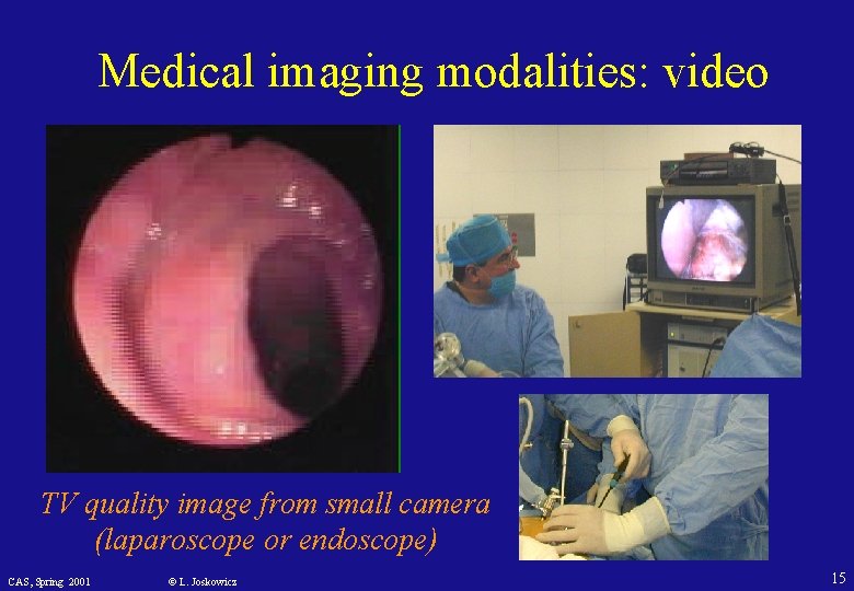 Medical imaging modalities: video TV quality image from small camera (laparoscope or endoscope) CAS,