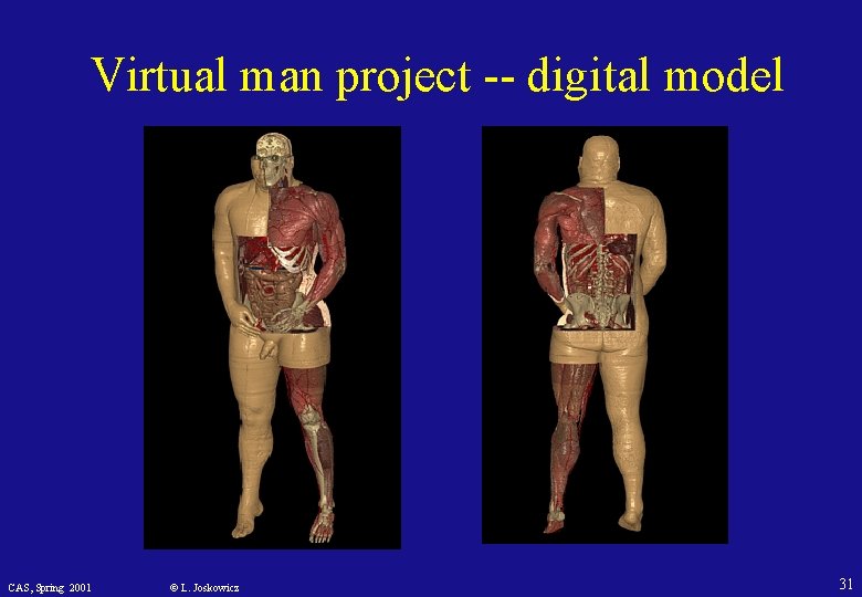 Virtual man project -- digital model CAS, Spring 2001 © L. Joskowicz 31 