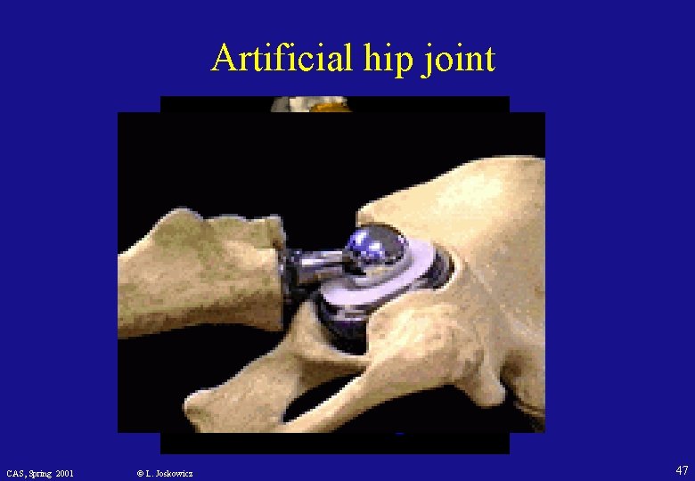 Artificial hip joint CAS, Spring 2001 © L. Joskowicz 47 