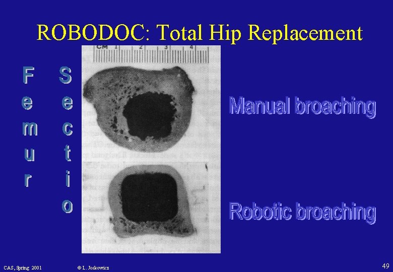 ROBODOC: Total Hip Replacement CAS, Spring 2001 © L. Joskowicz 49 