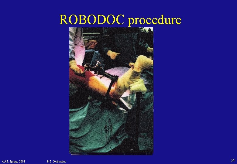 ROBODOC procedure CAS, Spring 2001 © L. Joskowicz 54 