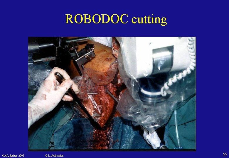 ROBODOC cutting CAS, Spring 2001 © L. Joskowicz 55 