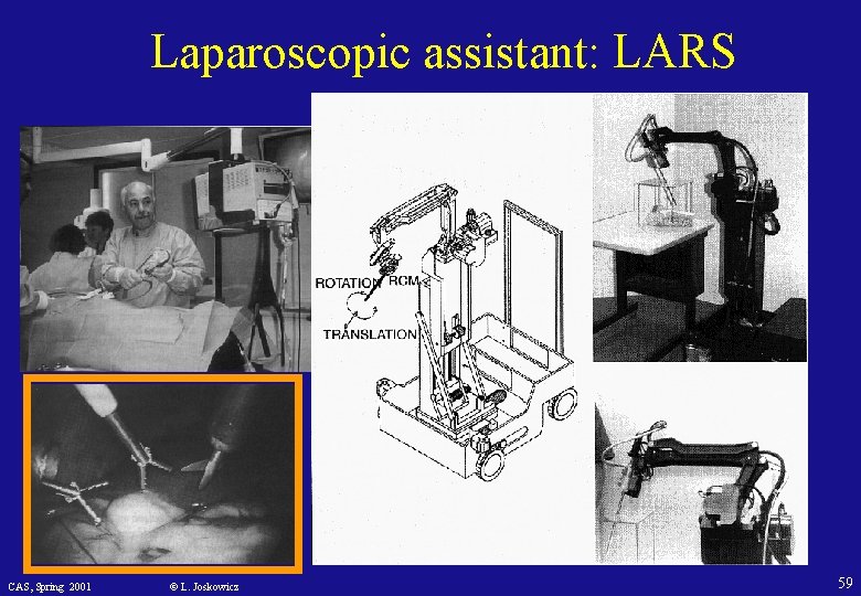 Laparoscopic assistant: LARS CAS, Spring 2001 © L. Joskowicz 59 