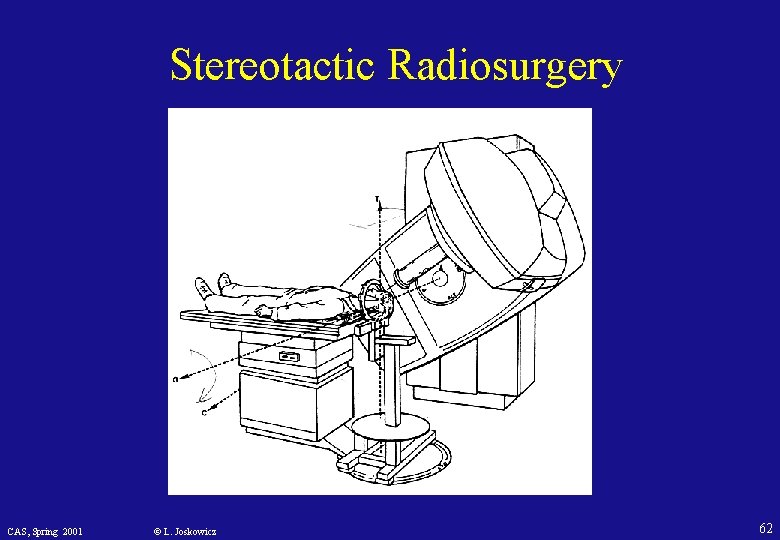 Stereotactic Radiosurgery CAS, Spring 2001 © L. Joskowicz 62 