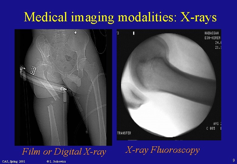 Medical imaging modalities: X-rays Film or Digital X-ray CAS, Spring 2001 © L. Joskowicz