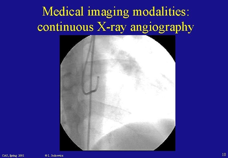 Medical imaging modalities: continuous X-ray angiography CAS, Spring 2001 © L. Joskowicz 10 