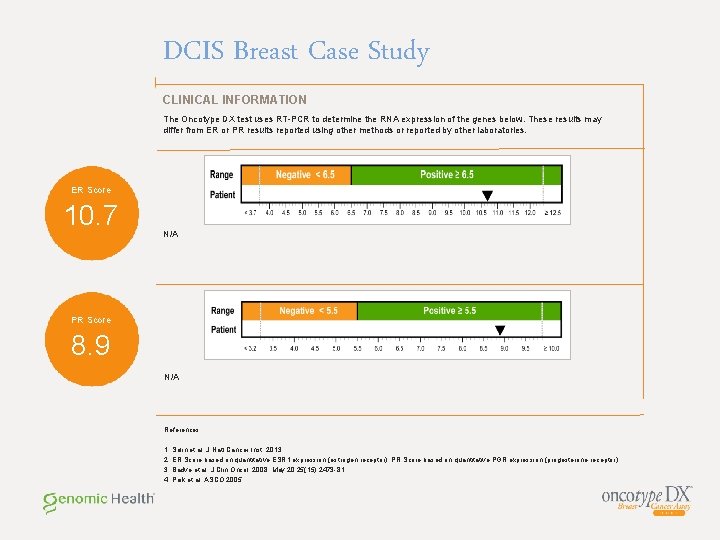 DCIS Breast Case Study CLINICAL INFORMATION The Oncotype DX test uses RT-PCR to determine