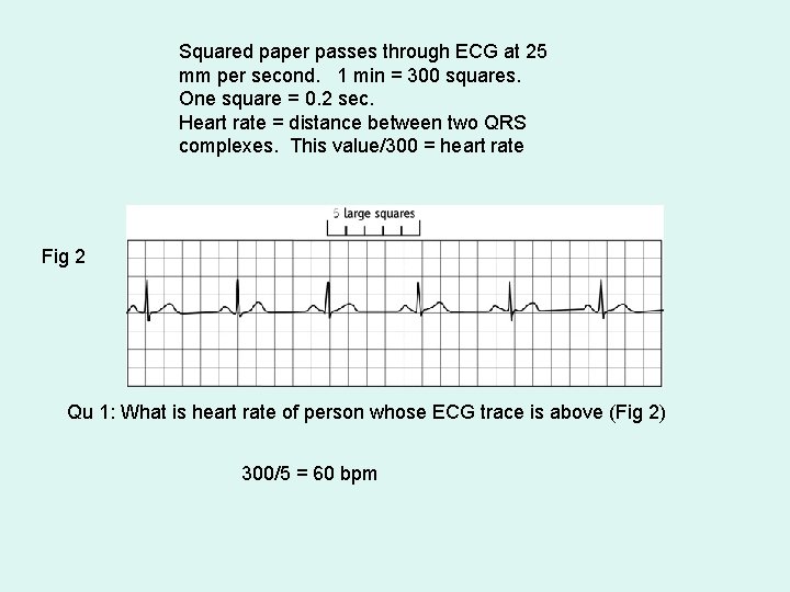 Squared paper passes through ECG at 25 mm per second. 1 min = 300