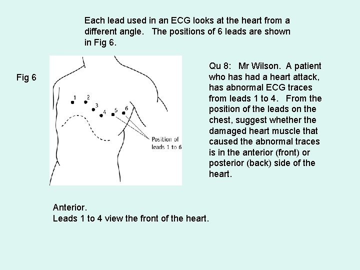 Each lead used in an ECG looks at the heart from a different angle.