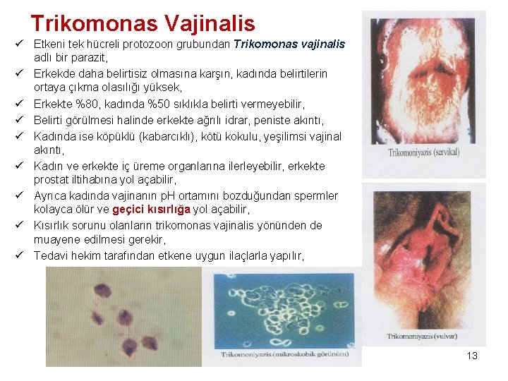 Trikomonas Vajinalis ü Etkeni tek hücreli protozoon grubundan Trikomonas vajinalis adlı bir parazit, ü