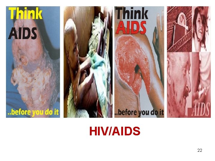 HIV/AIDS 22 