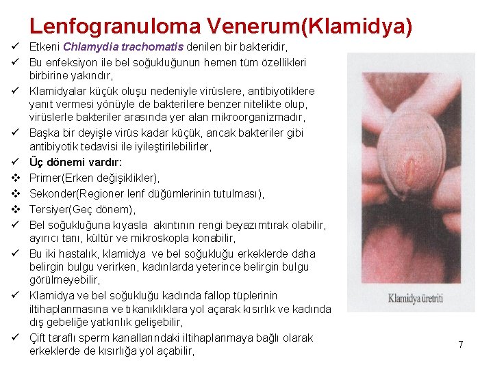 Lenfogranuloma Venerum(Klamidya) ü Etkeni Chlamydia trachomatis denilen bir bakteridir, ü Bu enfeksiyon ile bel