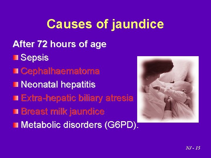 Causes of jaundice After 72 hours of age Sepsis Cephalhaematoma Neonatal hepatitis Extra-hepatic biliary