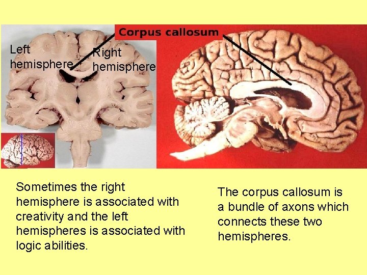 Left hemisphere Right hemisphere Sometimes the right hemisphere is associated with creativity and the