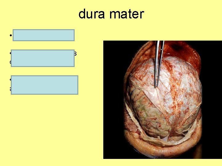 dura mater • Outer most layer • Tough white fibrous connective tissue • Many