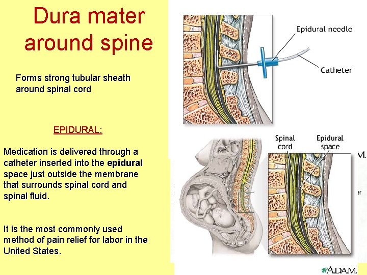 Dura mater around spine Forms strong tubular sheath around spinal cord EPIDURAL: Medication is