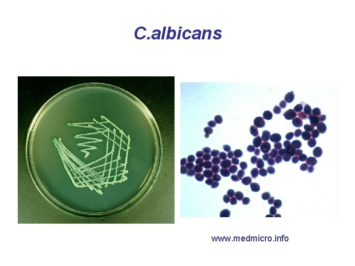 C. albicans www. medmicro. info 