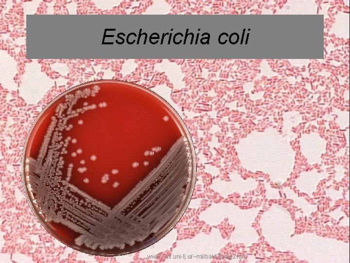 Escherichia coli www 2. mf. uni-lj. si/~mil/bakt 2. htm 