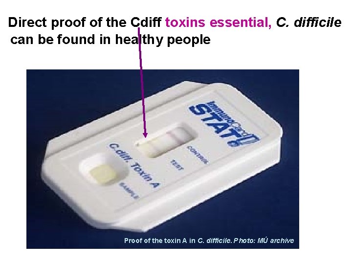 Direct proof of the Cdiff toxins essential, C. difficile can be found in healthy