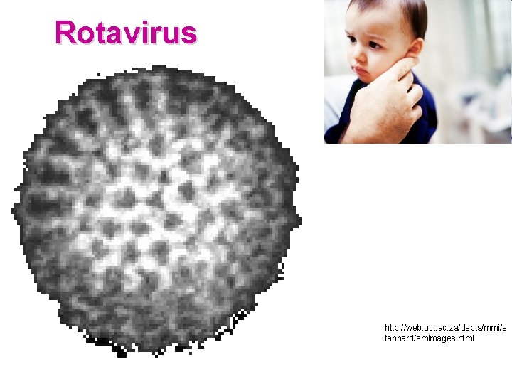 Rotavirus http: //web. uct. ac. za/depts/mmi/s tannard/emimages. html 