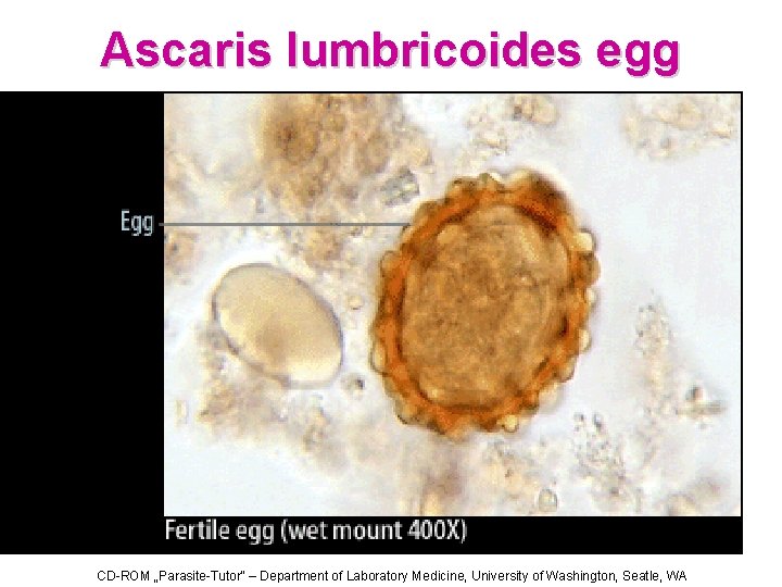 Ascaris lumbricoides egg CD-ROM „Parasite-Tutor“ – Department of Laboratory Medicine, University of Washington, Seatle,